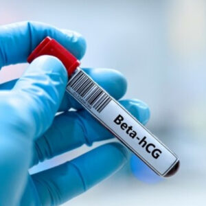 Beta Human Chorionic Gonadotrophin (Beta HCG)