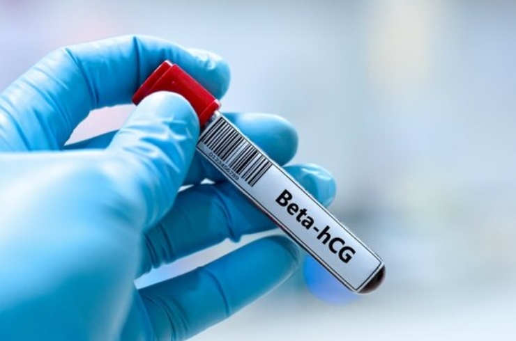 Beta Human Chorionic Gonadotrophin (Beta HCG)