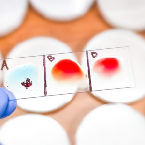 Blood Grouping with Rh Type