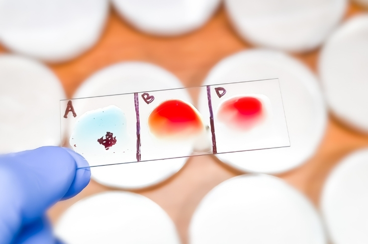 Blood Grouping with Rh Type