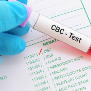 Complete Blood Count with ESR (CBC with ESR)