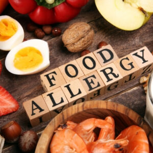 Complete Food Allergy Panel (Immunocap)