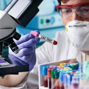 Complete blood count (CBC)Complete blood count (CBC)