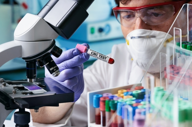 Complete blood count (CBC)Complete blood count (CBC)