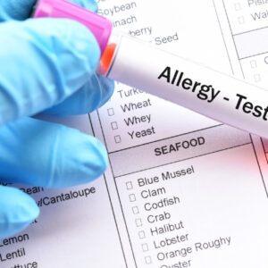Comprehensive Allergy Package (IgE, 236 items)