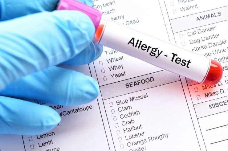 Comprehensive Allergy Package (IgE, 236 items)