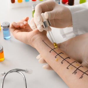 Comprehensive Allergy Panel (Immunocap)