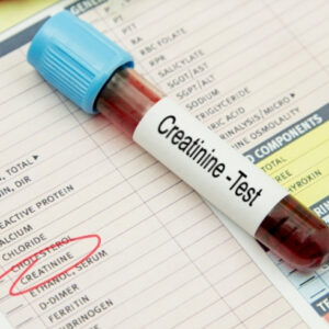 Creatinine