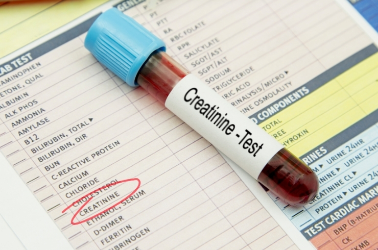 Creatinine