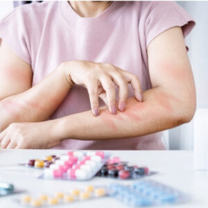 Drug Allergy Package