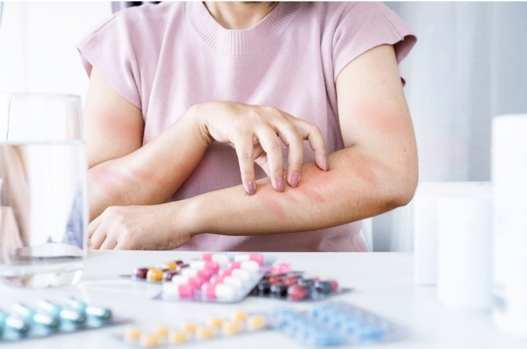 Drug Allergy Package