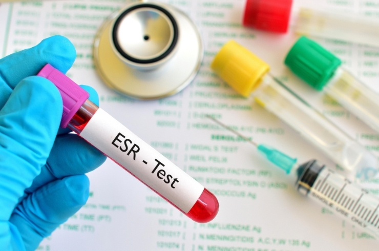 Erythrocyte Sedimentation Rate (ESR)