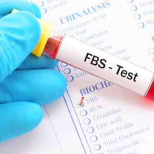 Fasting Blood Glucose