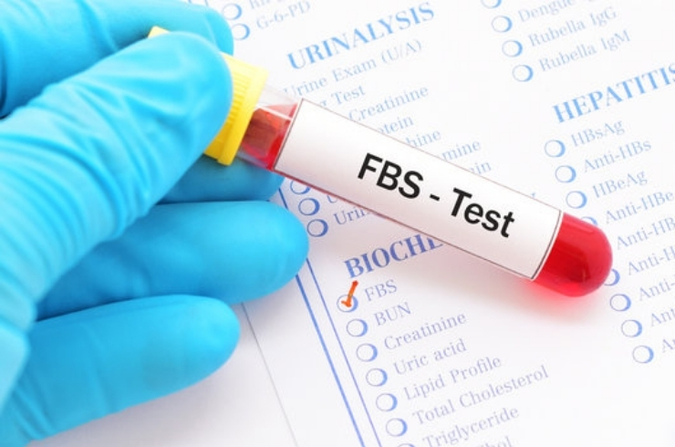 Fasting Blood Glucose
