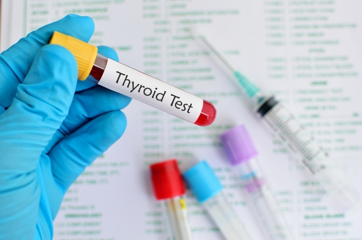 Free Thyroid Profile (Free TFT) [Free T3, Free T4, Free TSH]
