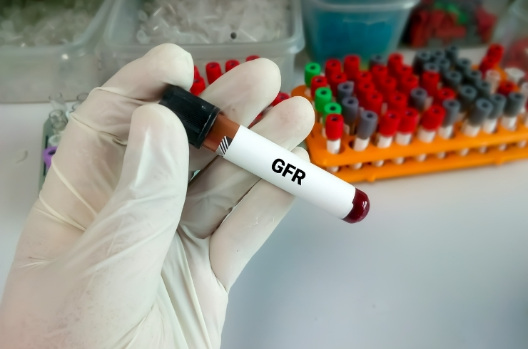 Glomerular Filtration Rate ( GFR )