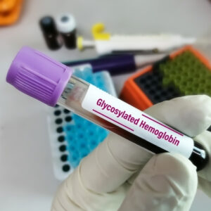Glycosylated Haemoglobin (HbA1c)