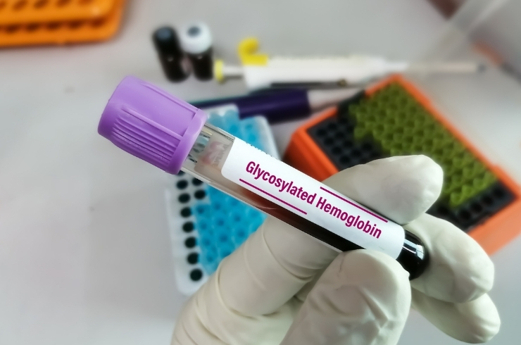 Glycosylated Haemoglobin (HbA1c)