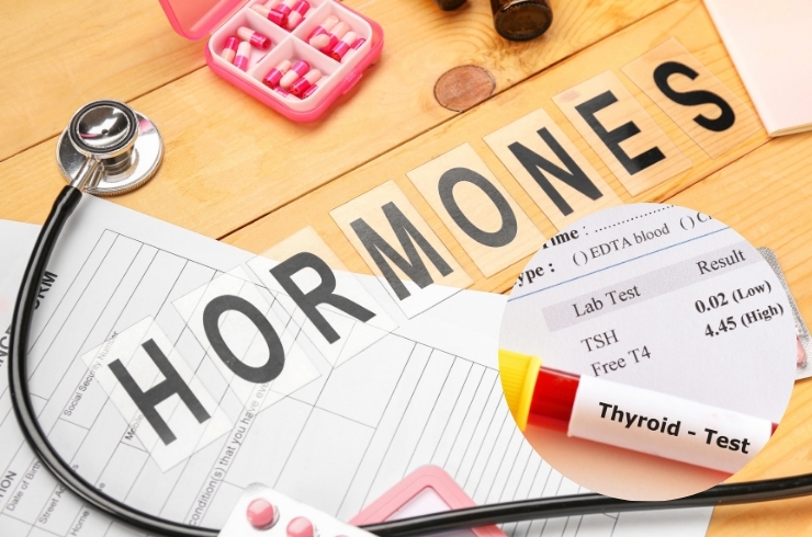 Hormonal and Thyroid Testing---32