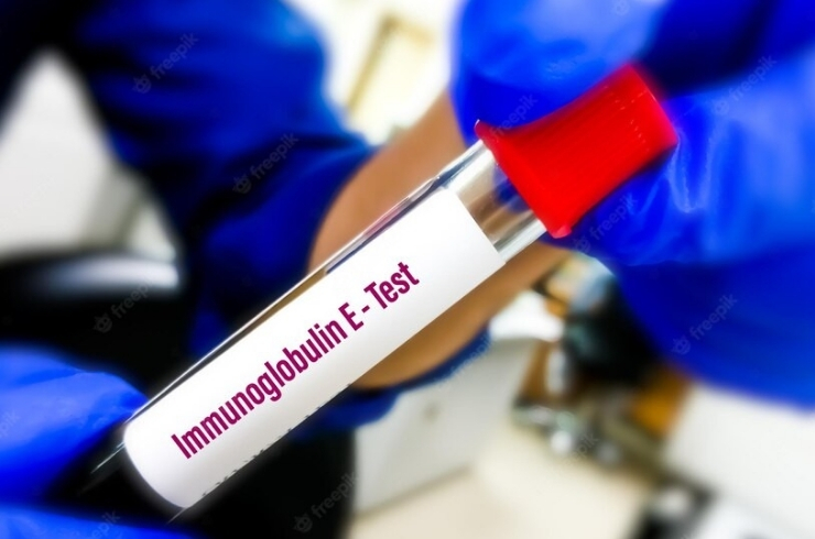 Immunoglobulin – IgE Total