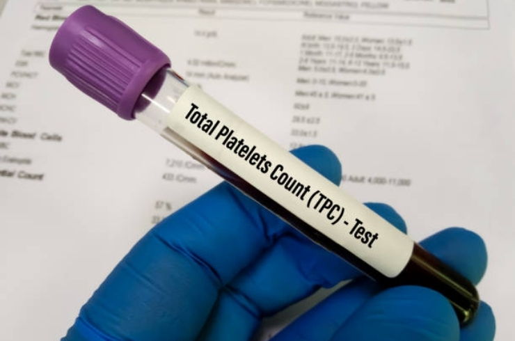 Platelet Count (PC)