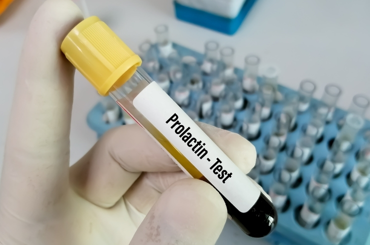 Prolactin