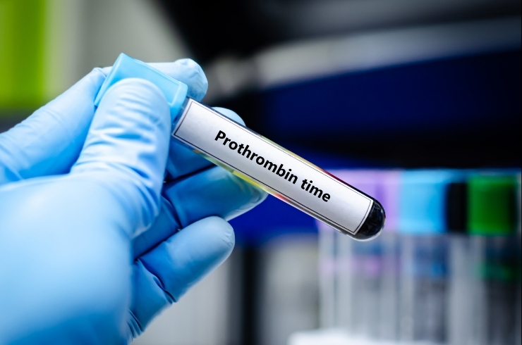 Prothrombin Time ( PT )