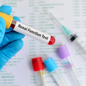 Renal Function Test without Urine Routine (RFT)