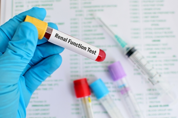 Renal Function Test without Urine Routine (RFT)