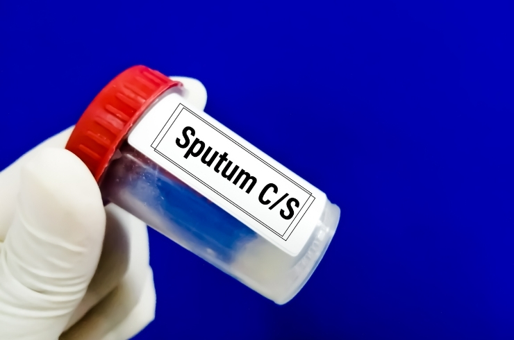 Sputum for Culture And Sensitivity