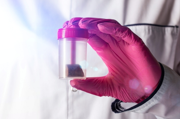 Stool Complete Analysis