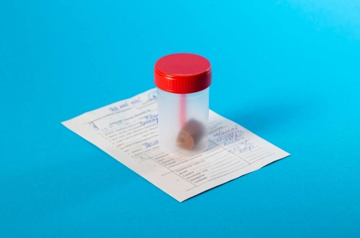 Stool for Culture And Sensitivity- Aerobic