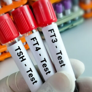Thyroid Profile (TFT) [T3,T4,TSH]