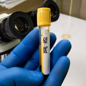 Thyroid Stimulating Hormone (TSH)
