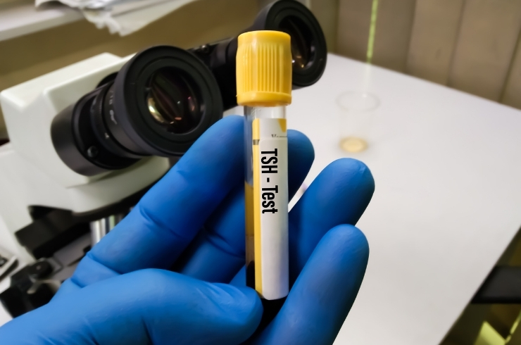 Thyroid Stimulating Hormone (TSH)