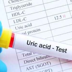 Uric Acid