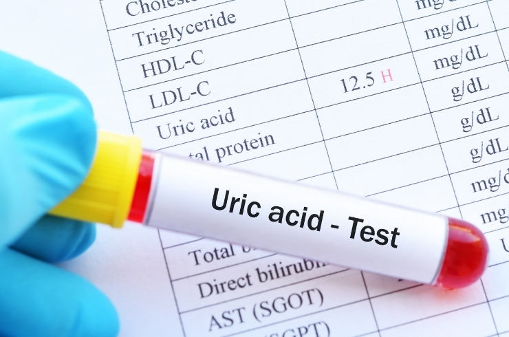 Uric Acid